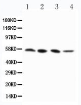 Anti-RIP3/RIPK3 Antibody Picoband® Boster Bio