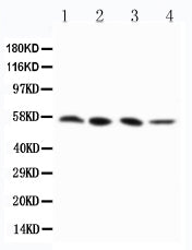 Anti-RIP3/RIPK3 Antibody Picoband® Boster Bio