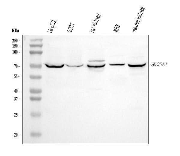 Anti-SGLT1/SLC5A1 Antibody Picoband® Boster Bio