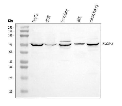 Anti-SGLT1/SLC5A1 Antibody Picoband® Boster Bio