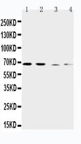Anti-CAT1/SLC7A1 Antibody Picoband® Boster Bio