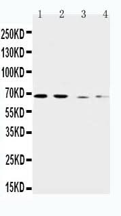 Anti-CAT1/SLC7A1 Antibody Picoband® Boster Bio