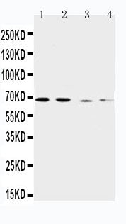 Anti-CAT1/SLC7A1 Antibody Picoband® Boster Bio