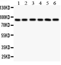 Anti-Toll-like receptor 1 TLR1 Antibody Picoband® Boster Bio