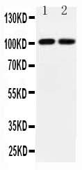 Anti-Glutamate receptor 3/GRIA3 Antibody Picoband® Boster Bio