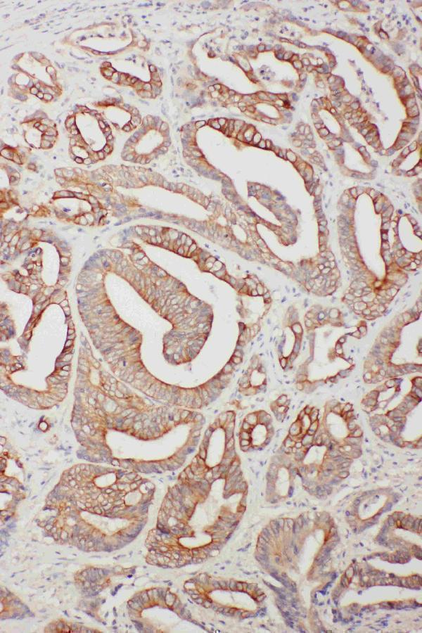 Anti-TNFAIP8L3 Antibody Picoband® Boster Bio