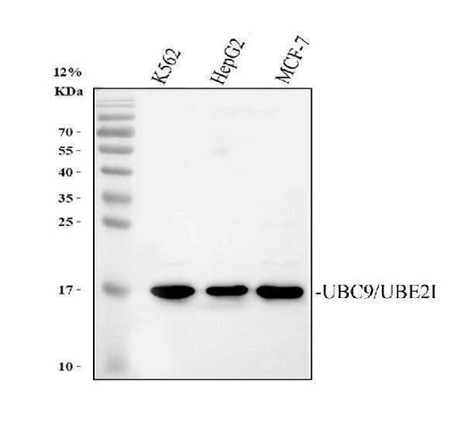 Anti-UBE2I/UBC9 Antibody Picoband® Boster Bio