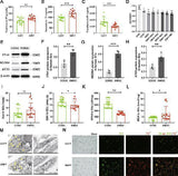Anti-APG5L/ATG5 Antibody Picoband® Boster Bio