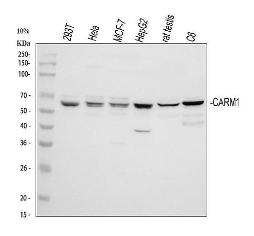 Anti-PRMT4/CARM1 Antibody Picoband® Boster Bio