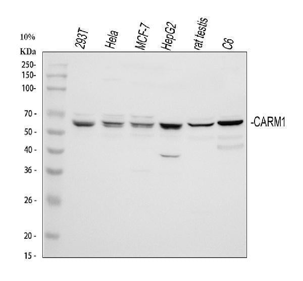 Anti-PRMT4/CARM1 Antibody Picoband® Boster Bio
