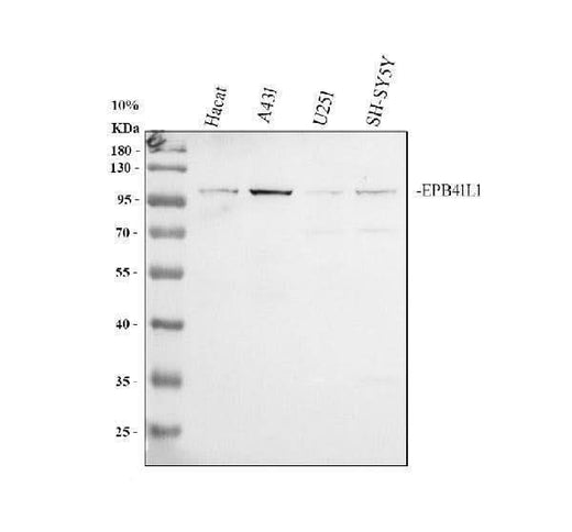 Anti-Band 4.1-like protein 1 EPB41L1 Antibody Picoband® Boster Bio