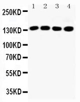 Anti-Insulin receptor substrate 1 IRS1 Antibody Picoband® Boster Bio