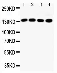 Anti-Insulin receptor substrate 1 IRS1 Antibody Picoband® Boster Bio