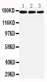 Anti-LRP5 Antibody Picoband® Boster Bio