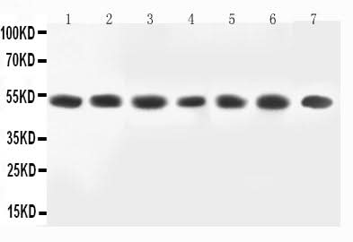 Anti-MEK2/MAP2K2 Antibody Picoband® Boster Bio