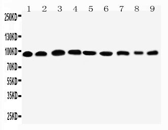 Anti-Plakophilin 2/PKP2 Antibody Picoband® Boster Bio