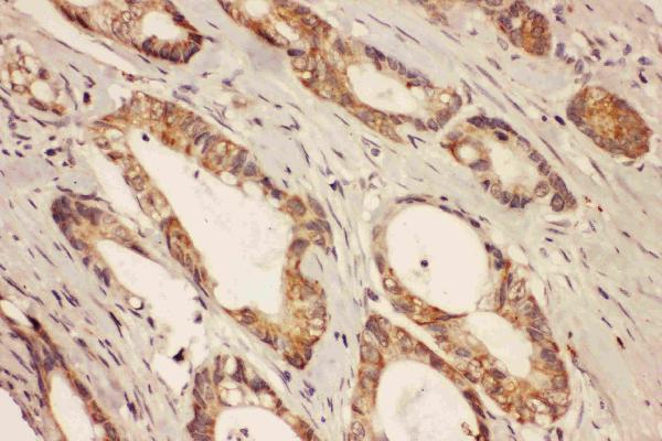 Anti-Ras-related protein Rab-8A RAB8A Antibody Picoband® Boster Bio