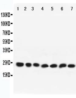 Anti-Rab9/RAB9A Antibody Picoband® Boster Bio