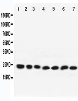 Anti-Rab9/RAB9A Antibody Picoband® Boster Bio
