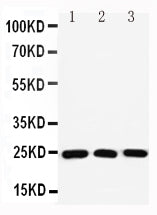Anti-Ras-related protein Rab-11A Rab11A Antibody Picoband® Boster Bio