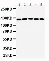 Anti-ST5 Antibody Picoband® Boster Bio