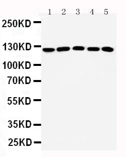 Anti-ST5 Antibody Picoband® Boster Bio
