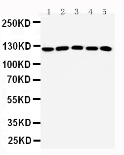 Anti-ST5 Antibody Picoband® Boster Bio