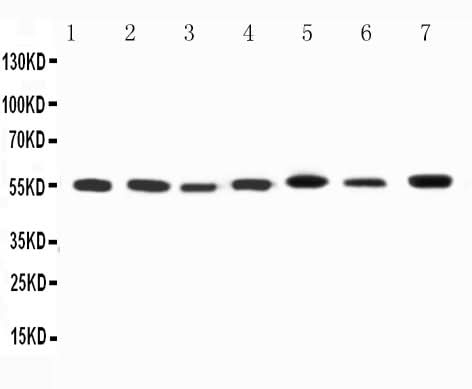 Anti-Kv1.1 potassium channel/KCNA1 Antibody Picoband® Boster Bio