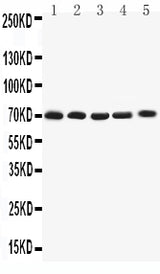 Anti-Kv1.4/KCNA4 Antibody Picoband® Boster Bio