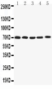 Anti-Kv1.4/KCNA4 Antibody Picoband® Boster Bio