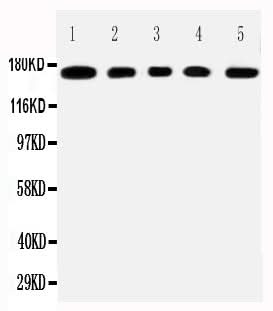 Anti-Mucin-1 MUC1 Antibody Picoband® Boster Bio