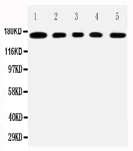 Anti-Mucin-1 MUC1 Antibody Picoband® Boster Bio