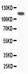 Anti-C5/C5a Antibody Picoband® Boster Bio