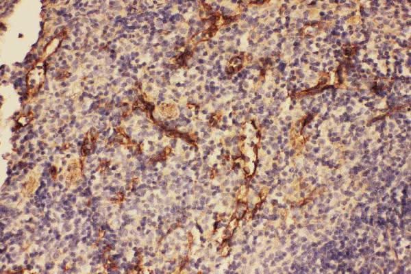 Anti-C5/C5a Antibody Picoband® Boster Bio