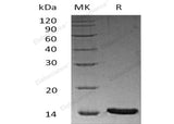 Recombinant Human LRRC3B Protein (His Tag) - ABMIUM