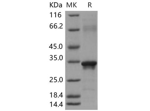 Recombinant Human Beta-amyloid 39/Beta-APP39 Protein (aa 672-710, His & GST Tag) - ABMIUM