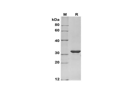 SDS-PAGE analysis of Human KLK10 proteins, 2 μg/lane of Recombinant Human KLK10 proteins was resolved with SDS-PAGE under reducing conditions, showing bands at 32 kDa.
