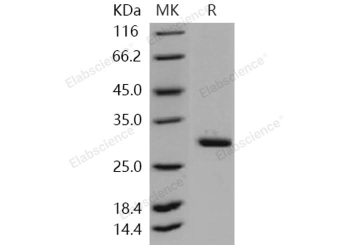Recombinant Human METTL1 Protein (His Tag) - ABMIUM