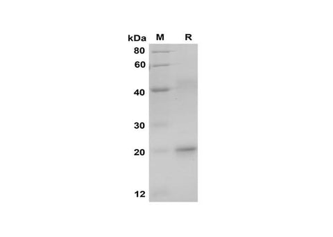 SDS-PAGE analysis of Human OXA proteins, 2 μg/lane of Recombinant Human OXA proteins was resolved with SDS-PAGE under reducing conditions, showing bands at 20 kDa.
