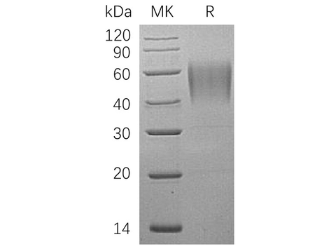 Recombinant Human ICAM-2/CD102 Protein (His Tag) - ABMIUM
