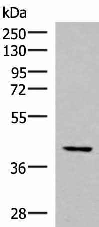 Anti-Human/Mouse/Rat IST1 Antibody