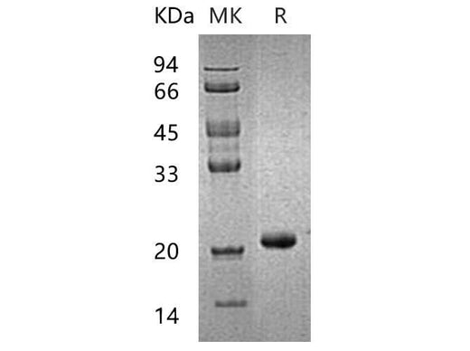 Recombinant Human HPCAL1 Protein (His Tag) - ABMIUM