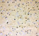Anti-DDAH1 Antibody Picoband® Boster Bio