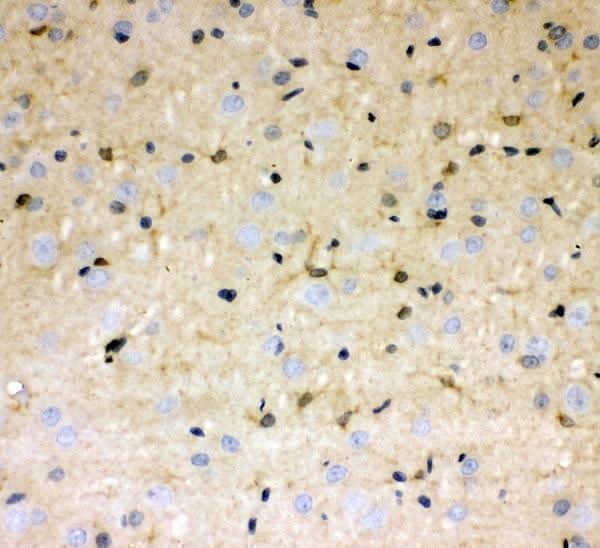 Anti-DDAH1 Antibody Picoband® Boster Bio