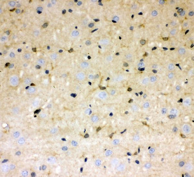 Anti-DDAH1 Antibody Picoband® Boster Bio