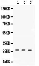 Anti-DDAH2 Antibody Picoband® Boster Bio