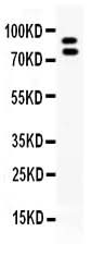 Anti-MMP9 Antibody Picoband® Boster Bio