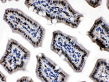 Anti-Visfatin/NAMPT Antibody Picoband® Boster Bio
