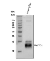 Anti-PF4 Antibody Picoband® Boster Bio