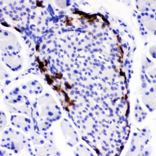 Anti-Peptide YY/PYY Antibody Boster Bio